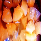 Ανανάς | Pineapple